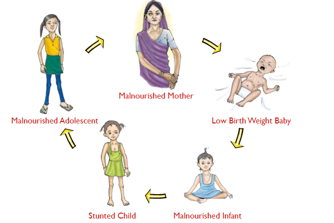 Undernutrition cycle: malnourished adolescent, malnourished mother, low birth weight baby, malnourished infant, stunted child